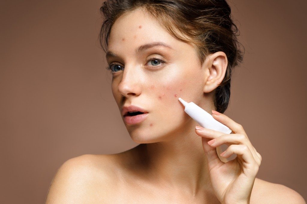 struggling with acne
