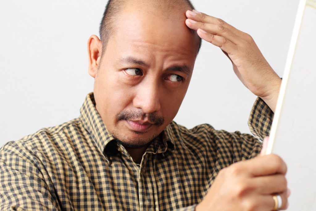Coping with Hair Loss: What Are the Things You Could Do