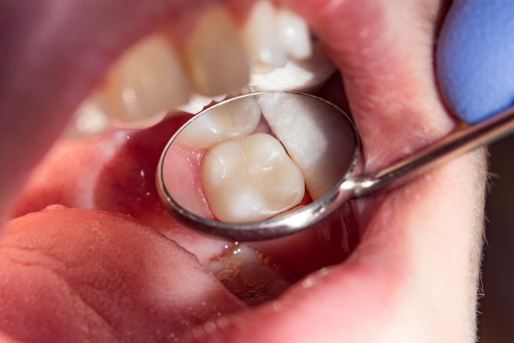 dentist concave mirror