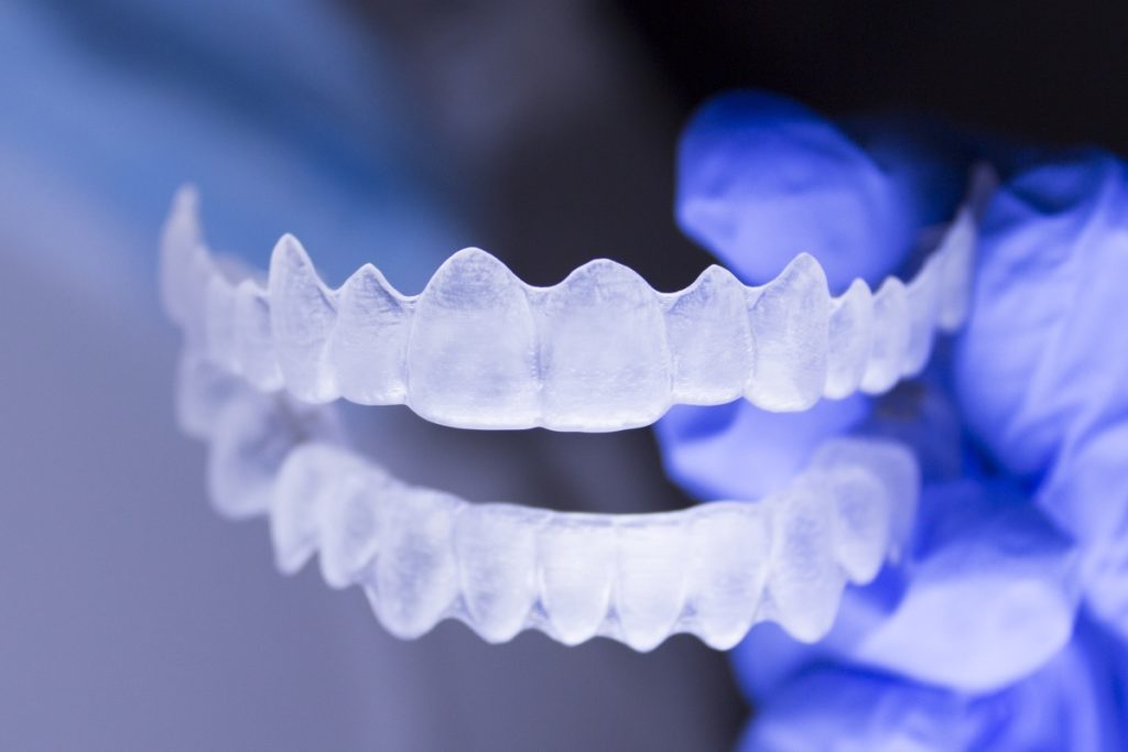 clear retainers
