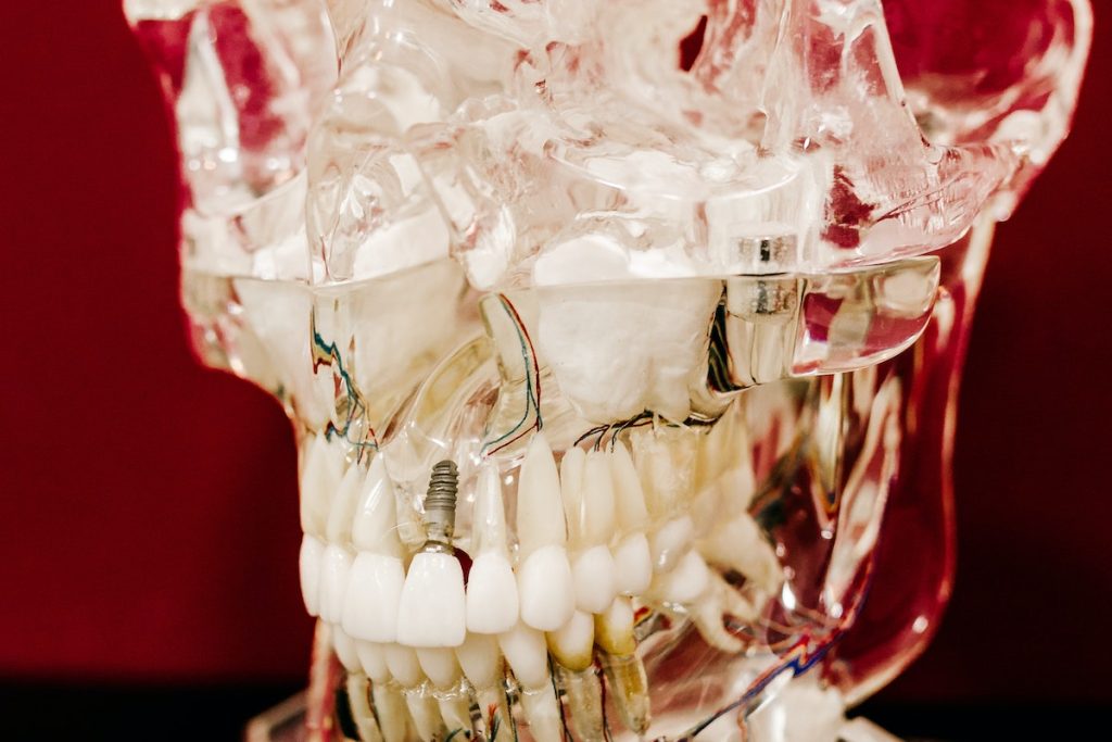 Jaw model in transparent skull on table