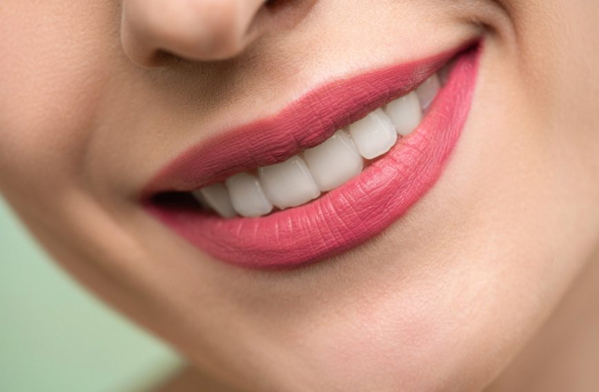 smile